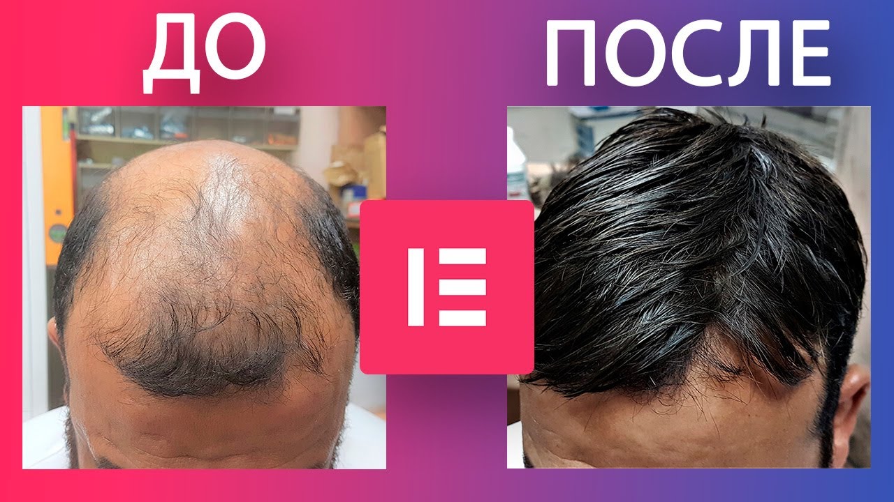 Сравнение «До и После» в Elementor: Лучший бесплатный виджет
